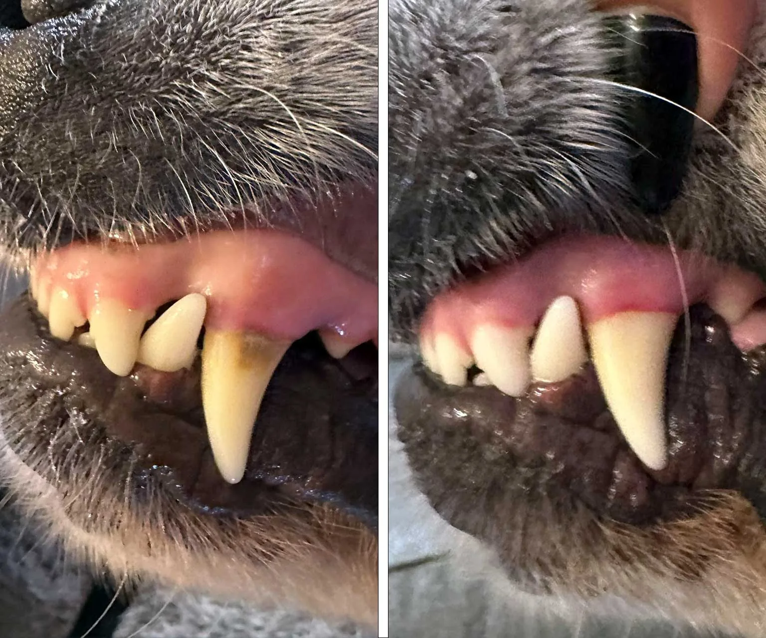 Teeth cleaning